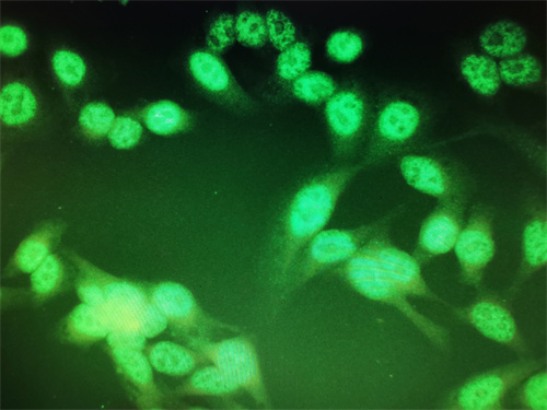 明慧显微镜摄像头和荧光模块成像应用于奥林巴斯生物显微镜CX23