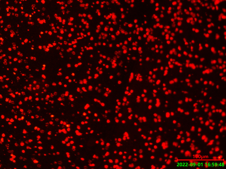耐可视研究型倒置荧光显微镜搭配荧光相机应用于脑细胞研究工作-广州明慧科技显微镜公司