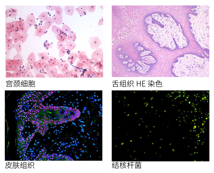 病理研究用显微镜NE900系列_FISH 荧光成像系统
