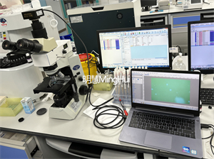 明慧荧光模块和显微镜相机助力广州某医院用于检测白带