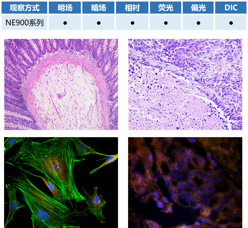 生物显微镜NE910成像效果图正置生物显微镜NE910-广州明慧
