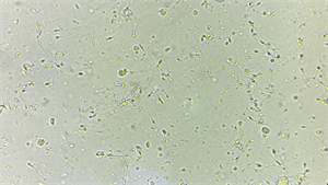 MHIL-200倒置生物显微镜观察精子成像图