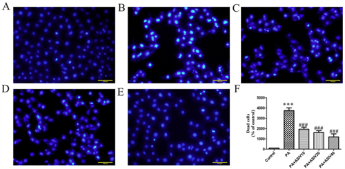 荧光活细胞成像应用案例：荧光显微镜观察细胞凋亡