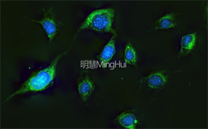 明慧的三色LED倒置荧光显微镜MHIF2000和高清显微镜摄像头MHS900的结合，助力南科医学大学进行细胞多色荧光观察。