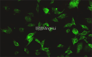 明慧倒置荧光显微镜 MHIF2000 + MHS900应用于活细胞多色荧光成像