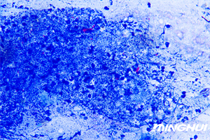 生物显微镜UB203i和显微镜摄像头MHD600助力检验科医院检测结核杆菌