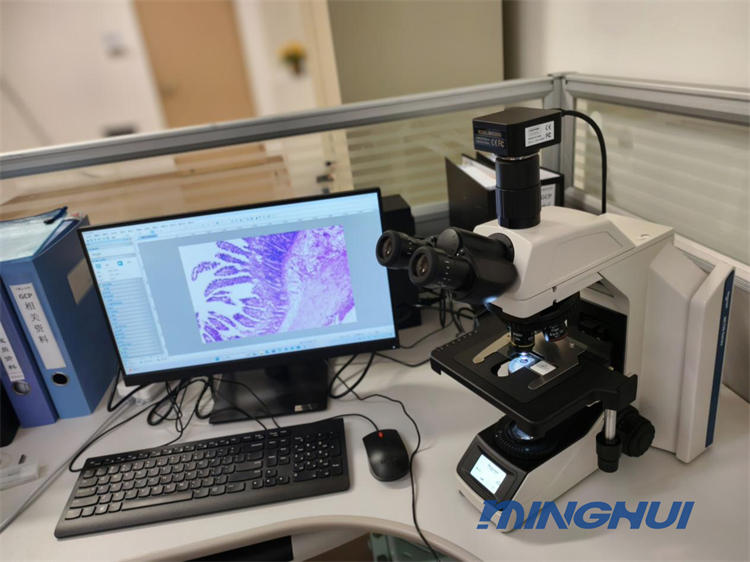 明慧生物显微镜NE710和相机MHD2000用于医院病理检验