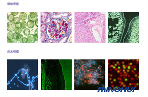 荧光显微镜解决方案特点-广州市明慧科技有限公司