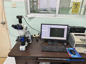 正置荧光显微镜UB203iFL和摄像头MHS600用于结核杆菌检测