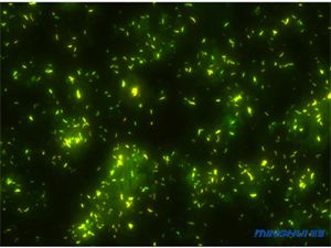  正置荧光显微镜UB203iFL和摄像头MHS600用于结核杆菌检测