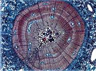 倒置生物显微镜MHIL-100应用效果(1)-明场观察