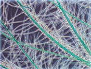 倒置生物显微镜MHIL-100应用效果(1)-相衬观察