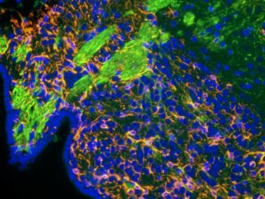 明慧电动倒置荧光附件应用效果图 (1)