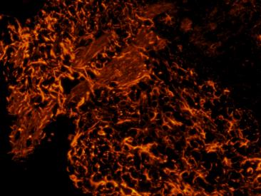 明慧电动倒置荧光附件应用效果图 (4)