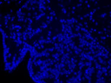明慧电动倒置荧光附件应用效果图 (6)