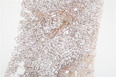 H20230246网织X100-1