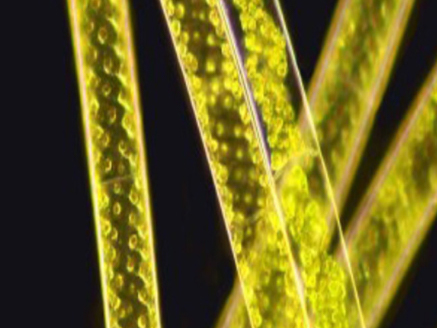 暗场--水绵-NE900显微镜