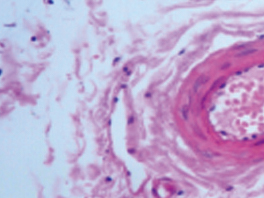 脊髓-镀银染色-NE900显微镜