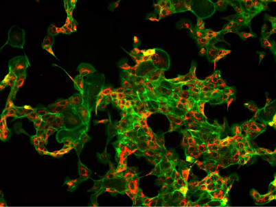 乳腺癌荧光NIB600