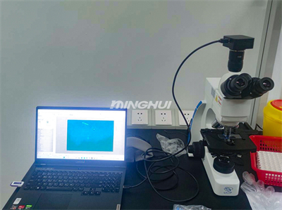 真菌荧光显微镜系统UB203i-FL和MHD600助力湖南某医院真菌检测