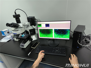 奥林巴斯BX53和荧光相机观察her-2荧光细胞1