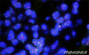 奥林巴斯BX53和荧光相机观察her-2荧光细胞4.jpg