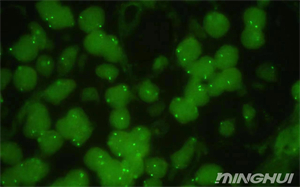 奥林巴斯BX53和荧光相机观察her-2荧光细胞5.jpg