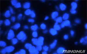 奥林巴斯BX53和荧光相机观察her-2荧光细胞6.jpg