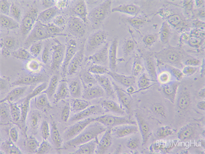 明慧MHIL150倒置显微镜和MHD1200显微镜摄像头应用于观察活体细胞
