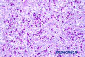 生物显微镜NE710+ MHD2000用于医院病理检验2.jpg