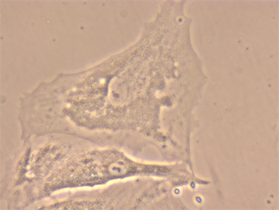 明慧NIB610倒置显微镜应用于细胞培养观察 明慧NIB610倒置显微镜应用于细胞培养观察
