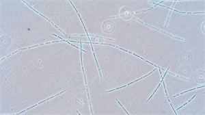 明慧MHD2000显微相机搭配奥林巴斯CX43,助力广州环境研究所藻类观察3.jpg 明慧MHD2000显微相机搭配奥林巴斯CX43,助力广州环境研究所藻类观察3.jpg