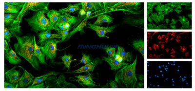倒置荧光显微镜MHIF3000-荧光样品图片.jpg 倒置荧光显微镜MHIF3000-荧光样品图片.jpg