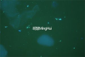 明慧荧光模块和显微镜相机助力奥林巴斯生物显微镜CX41升级荧光和摄像检测白带2.jpg 明慧荧光模块和显微镜相机助力奥林巴斯生物显微镜CX41升级荧光和摄像检测白带2.jpg