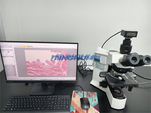 病理诊断升级：MHD2000+奥林巴斯BX51