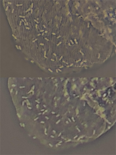 细胞生物：相差效果对比，分辨率对比很明显