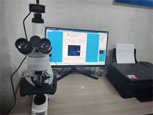 明慧UV-LED-MH荧光模块助力福建漳州某医院真菌检测精准升级1