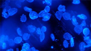 明慧UV-LED-MH荧光模块助力福建漳州某医院真菌检测精准升级2.jpg